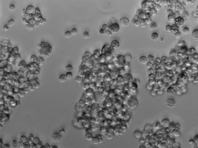 HL-60 Clone 15 Cell|人急性早幼粒细胞白血病细胞