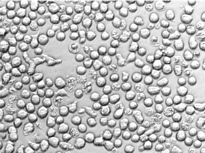HL-60 Clone 15 Cell|人急性早幼粒细胞白血病细胞