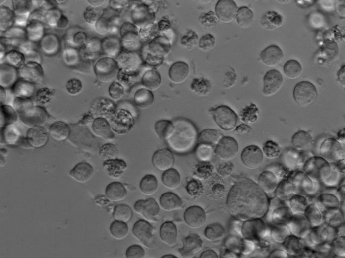 KG-1a Cell|人急性骨髓白血病细胞