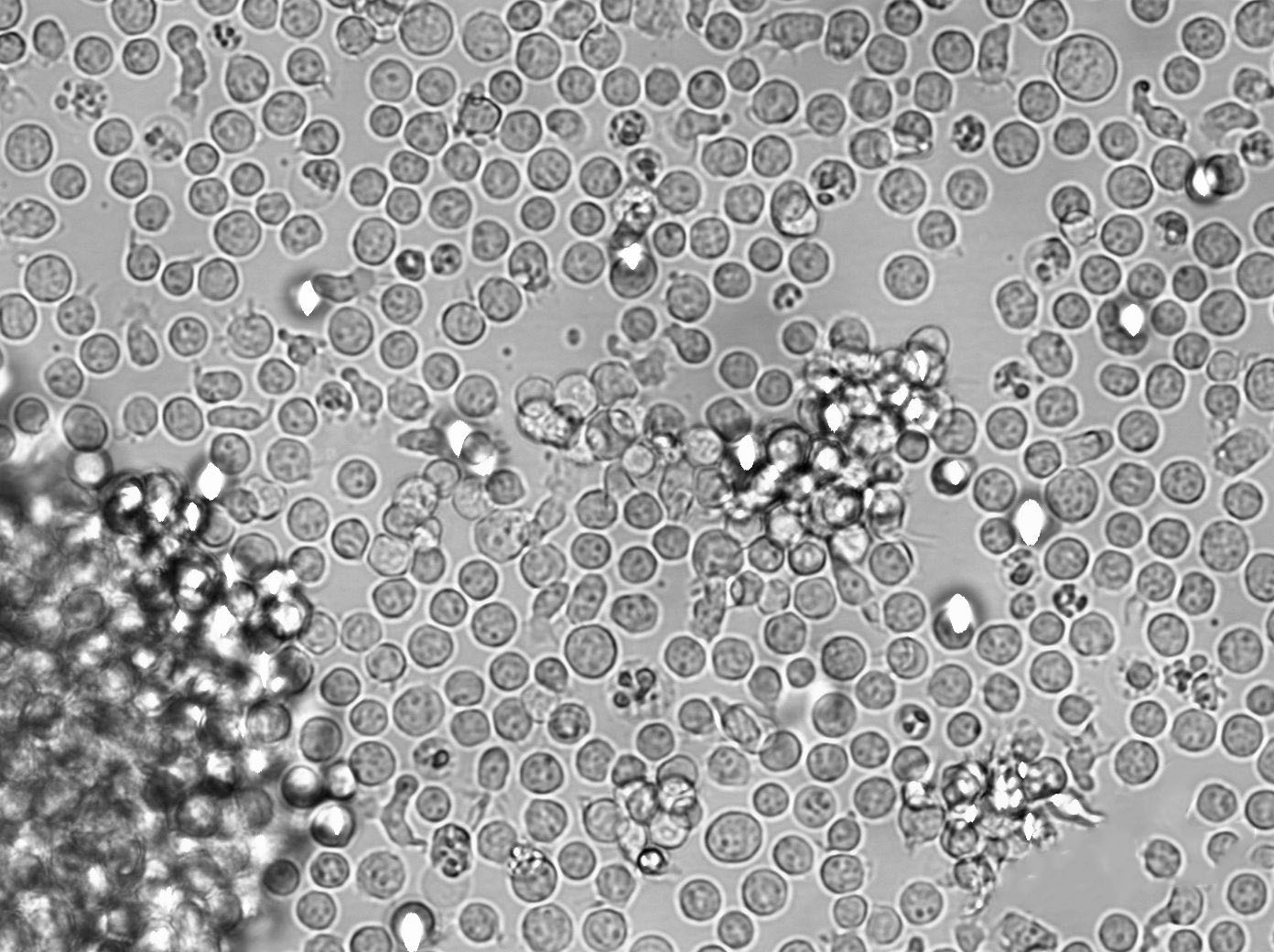 KBM-5 Cell|人慢性髓白血病细胞