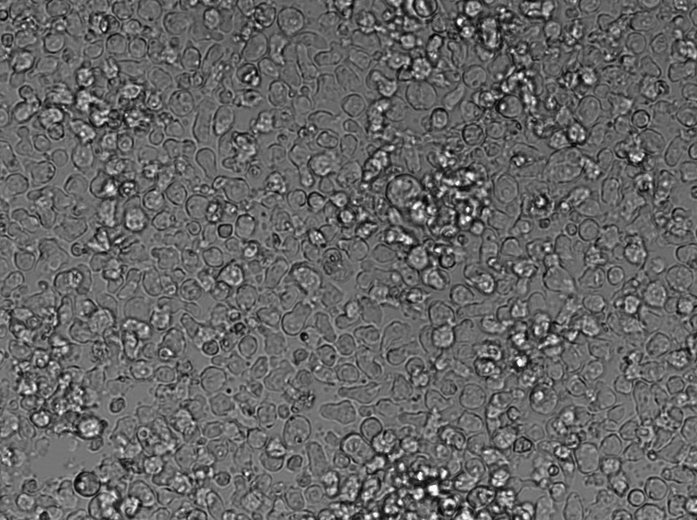 Karpas-299 Cell|人间变性大细胞淋巴瘤细胞