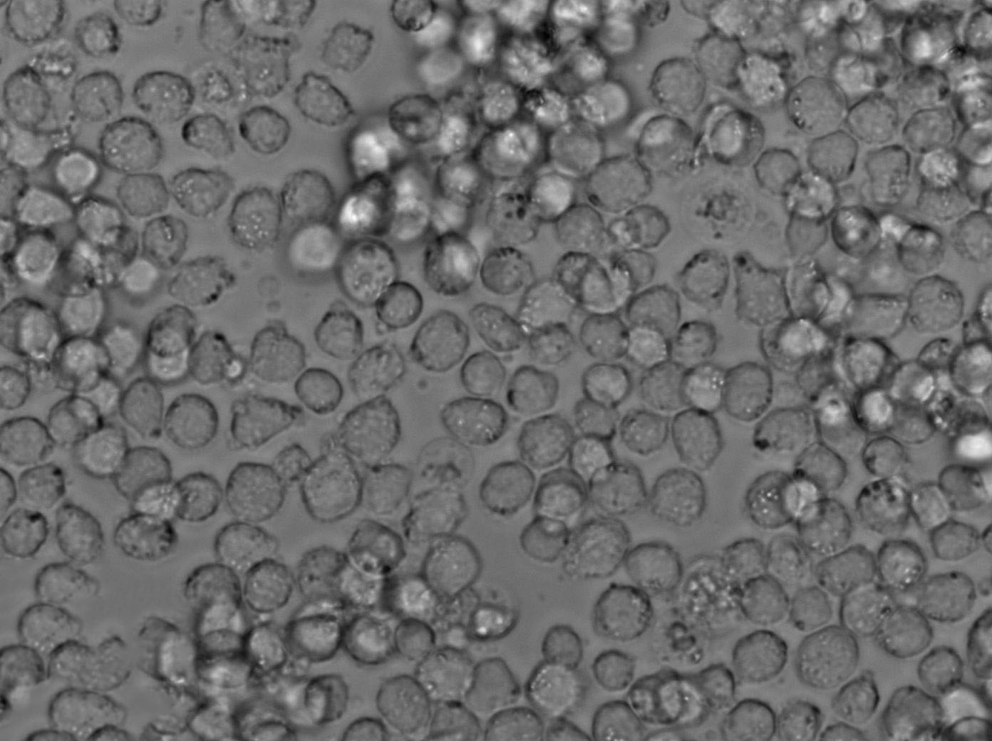 CTV-1 Cell|人急性T淋巴细胞白血病细胞