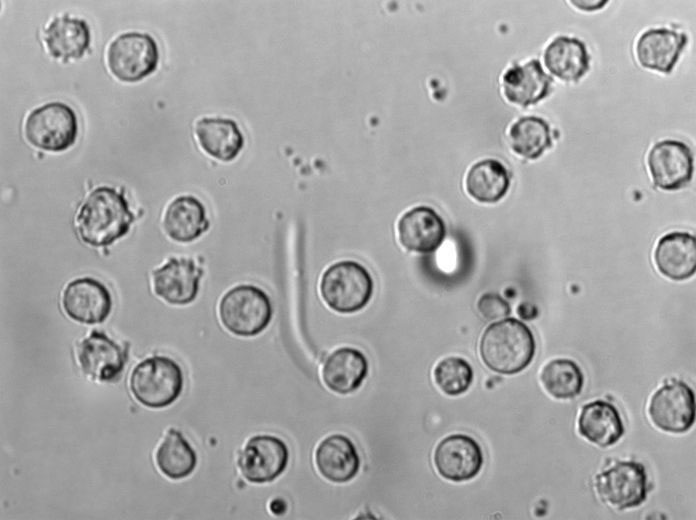 MDCC-MSB1 Cell|鸡淋巴瘤细胞