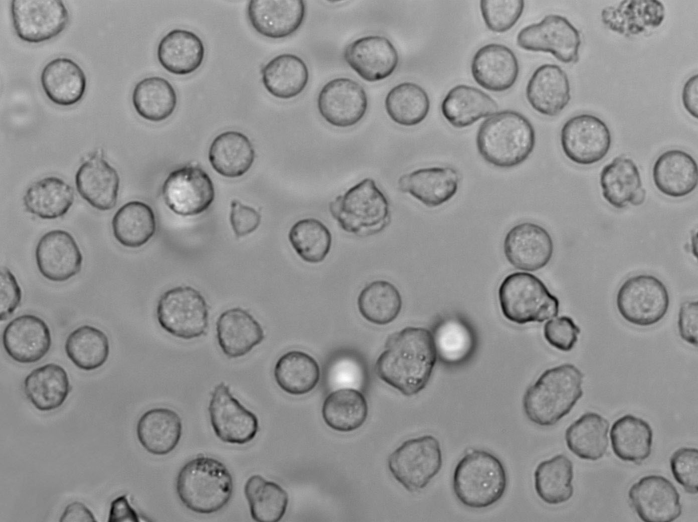 MyLa 2059 Cell|人皮肤T淋巴细胞瘤细胞