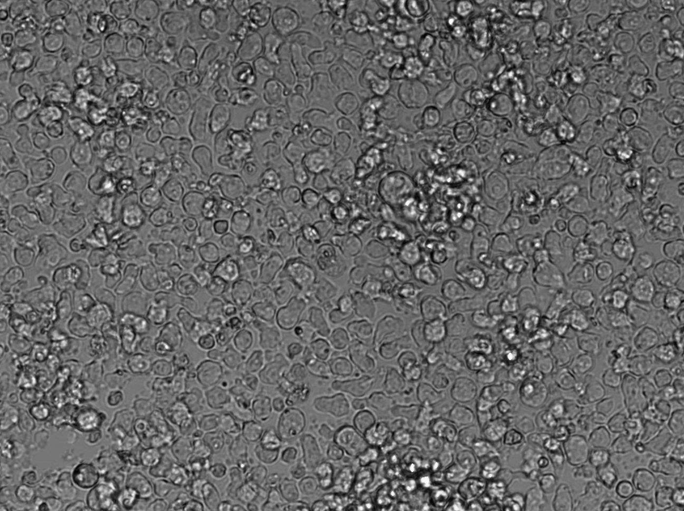 OCI-Ly10 Cell|人弥漫大B细胞淋巴瘤细胞