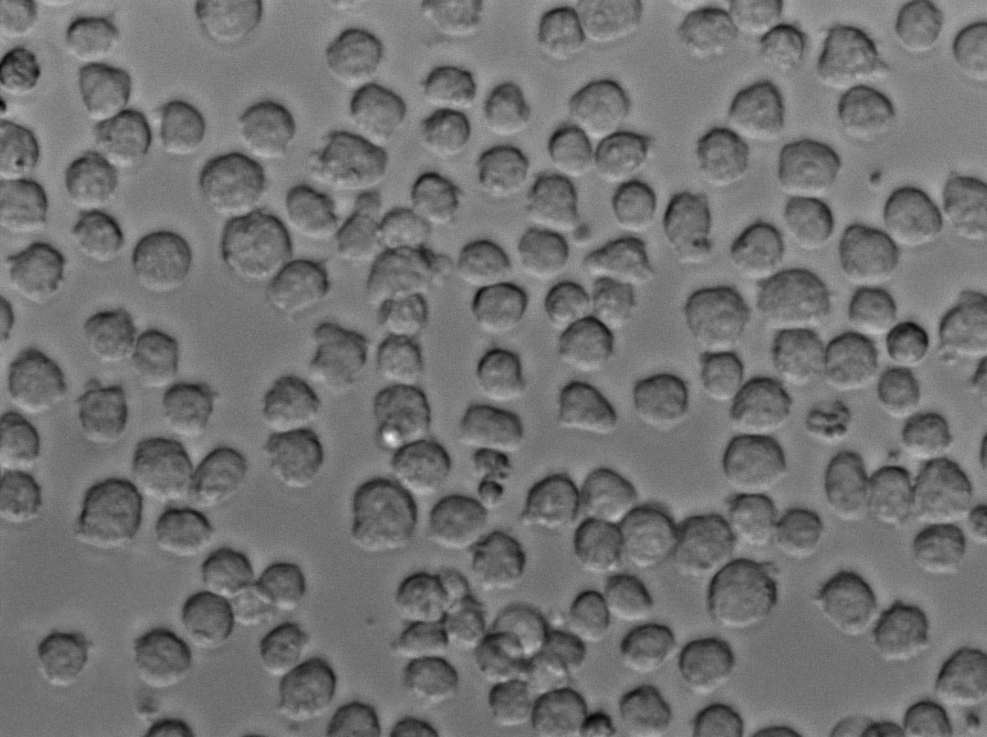 MOLM-16 Cell|人急性髓系白血病细胞