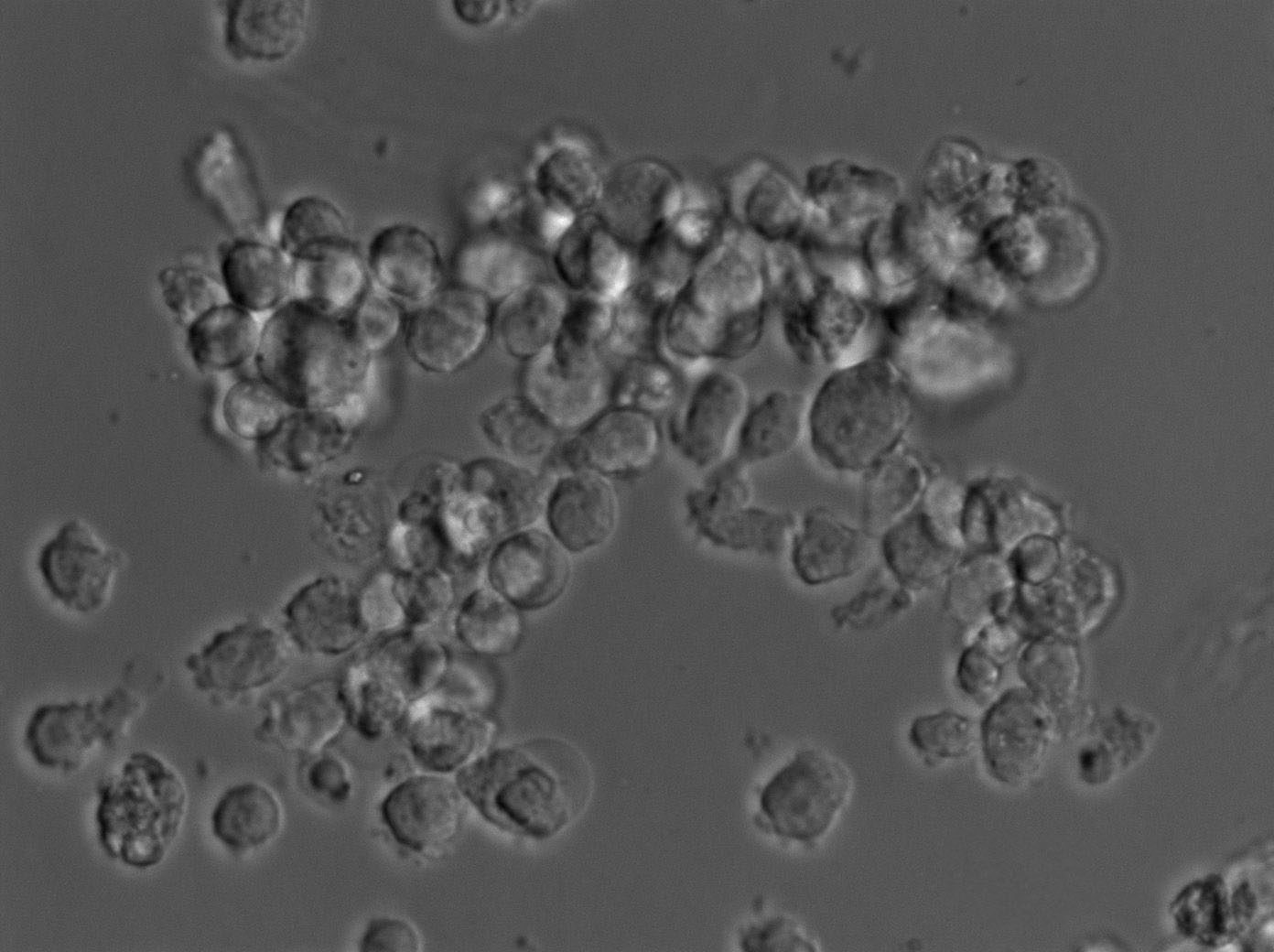 Wien 133 Cell|人非何杰金氏淋巴瘤细胞