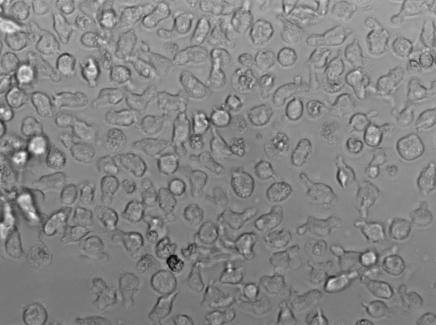 Wien 133 Cell|人非何杰金氏淋巴瘤细胞