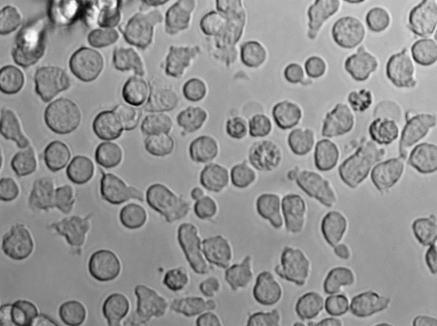 Kit225 Cell|人T淋巴细胞