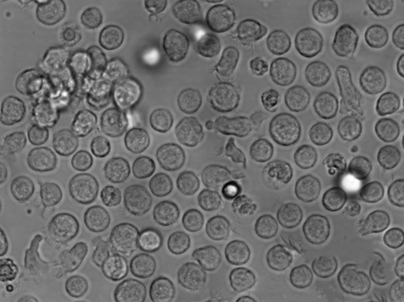 WEHI-231 Cell|小鼠B淋巴细胞