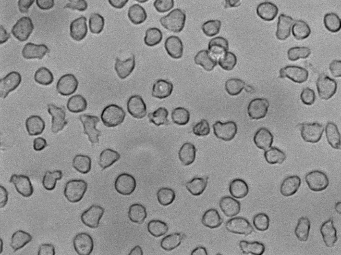 RPMI-7666 Cell|人外周血B淋巴细胞