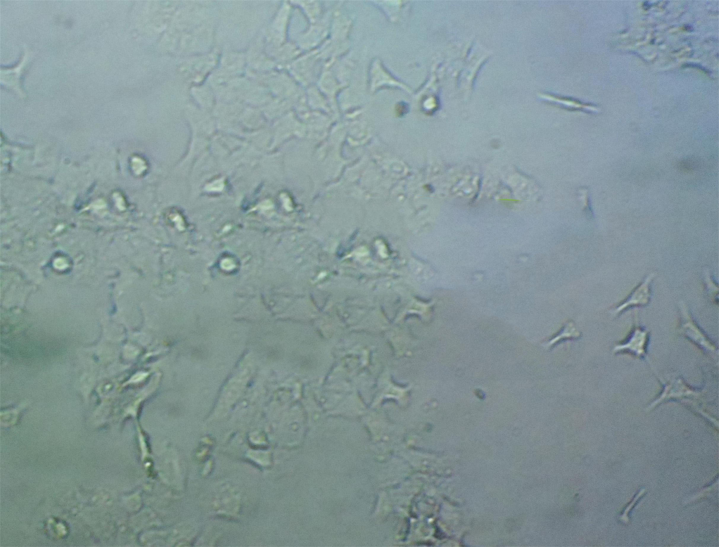 DLD-1 Cell|人结直肠腺癌上皮细胞