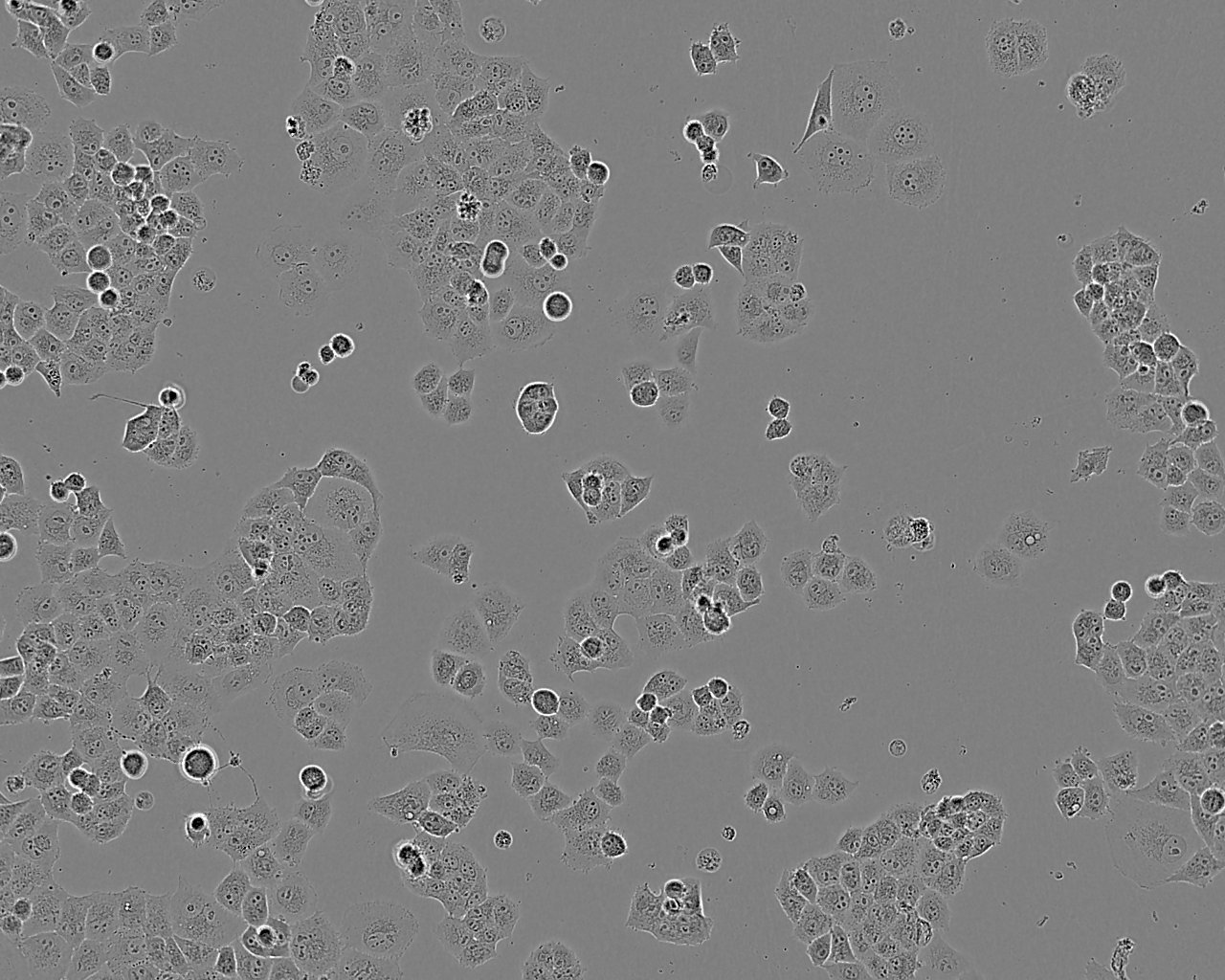 Calu-3 Cell|人肺腺癌细胞
