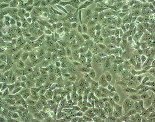 MHCC97-H Cell|高转移人肝癌细胞