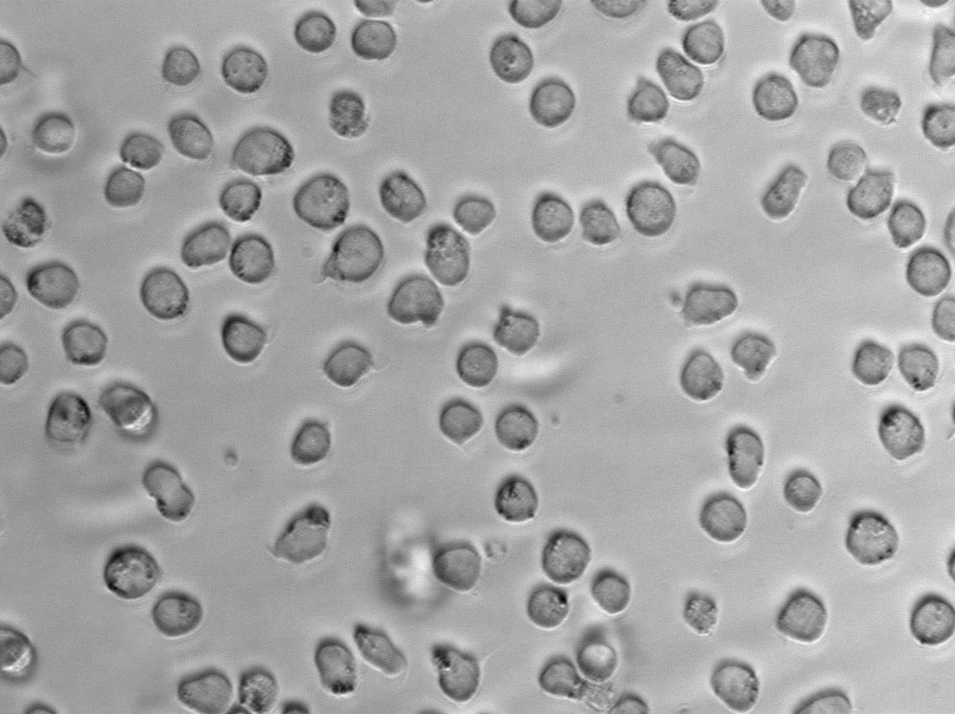MOLT-4人急性淋巴母细胞性白血病复苏细胞(附STR鉴定报告)