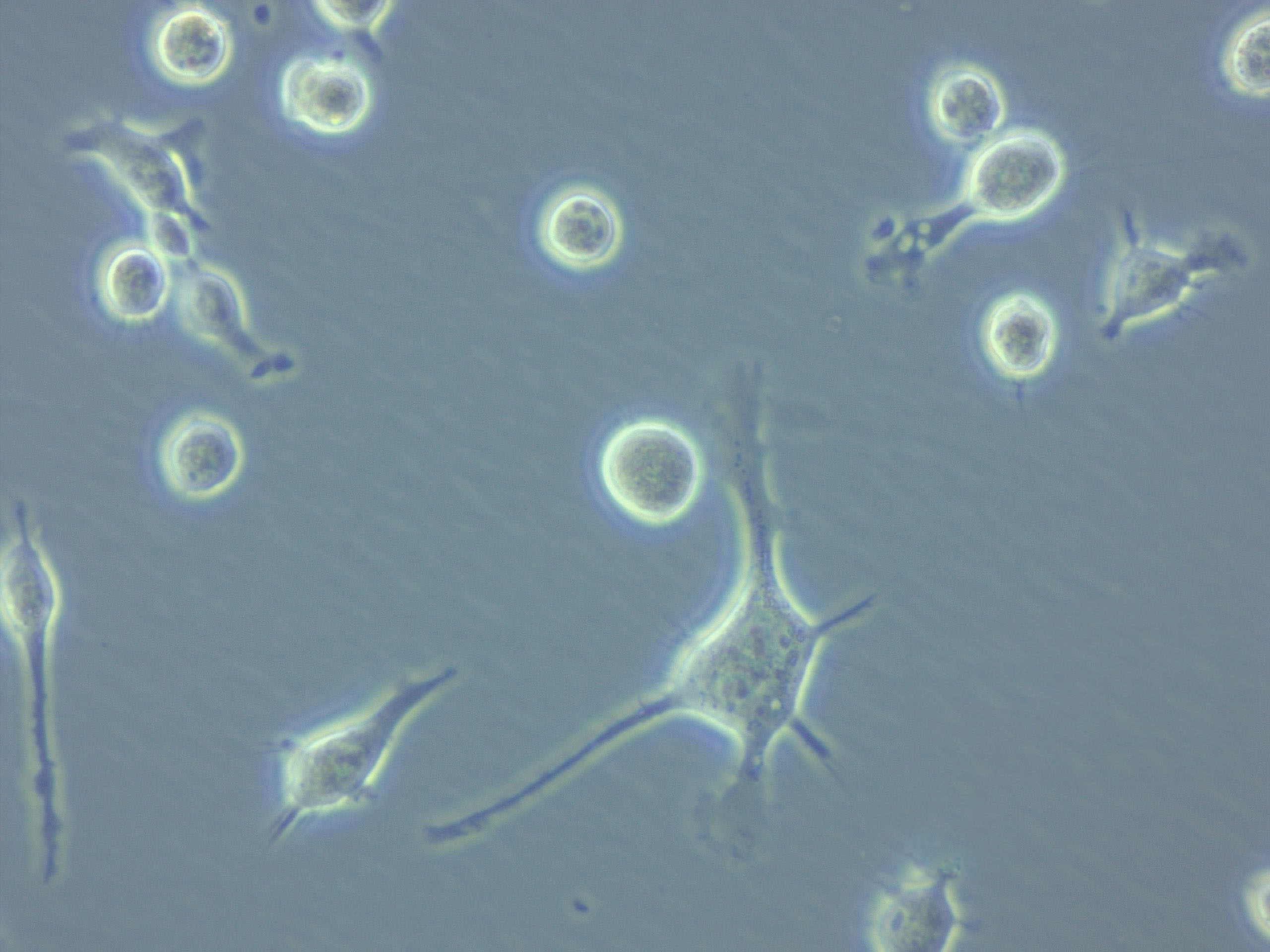 GDM-1人白血病复苏细胞(附STR鉴定报告)