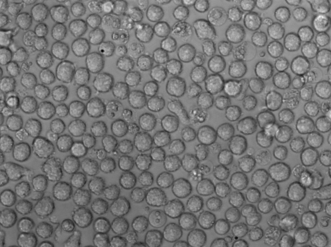 NCI-H929人浆细胞白血病复苏细胞(附STR鉴定报告)