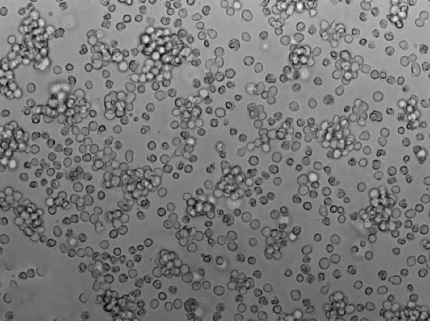 SU-DHL-4人弥漫性组织淋巴瘤复苏细胞(附STR鉴定报告)