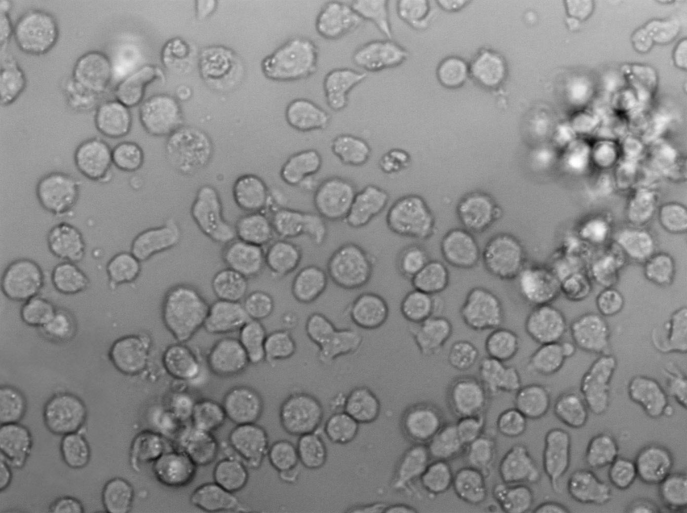 SU-DHL-10人B细胞淋巴瘤复苏细胞(附STR鉴定报告)