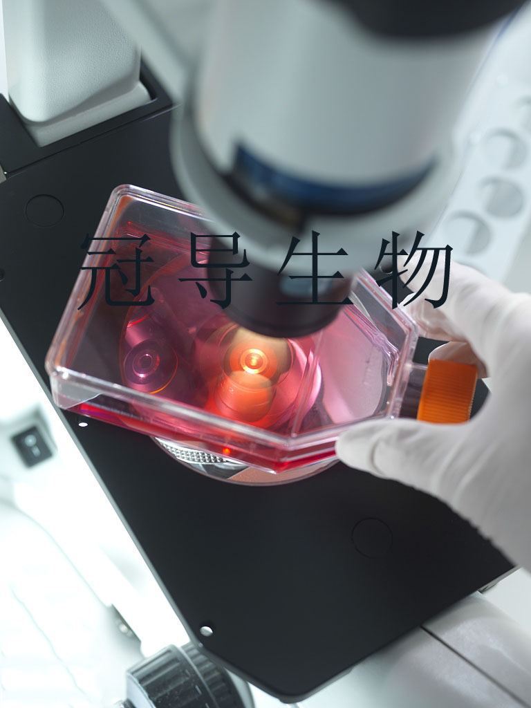 38C13小鼠B淋巴瘤复苏细胞(附STR鉴定报告)