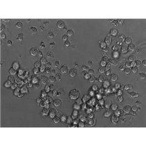 HuT 78人T淋巴瘤复苏细胞(附STR鉴定报告)