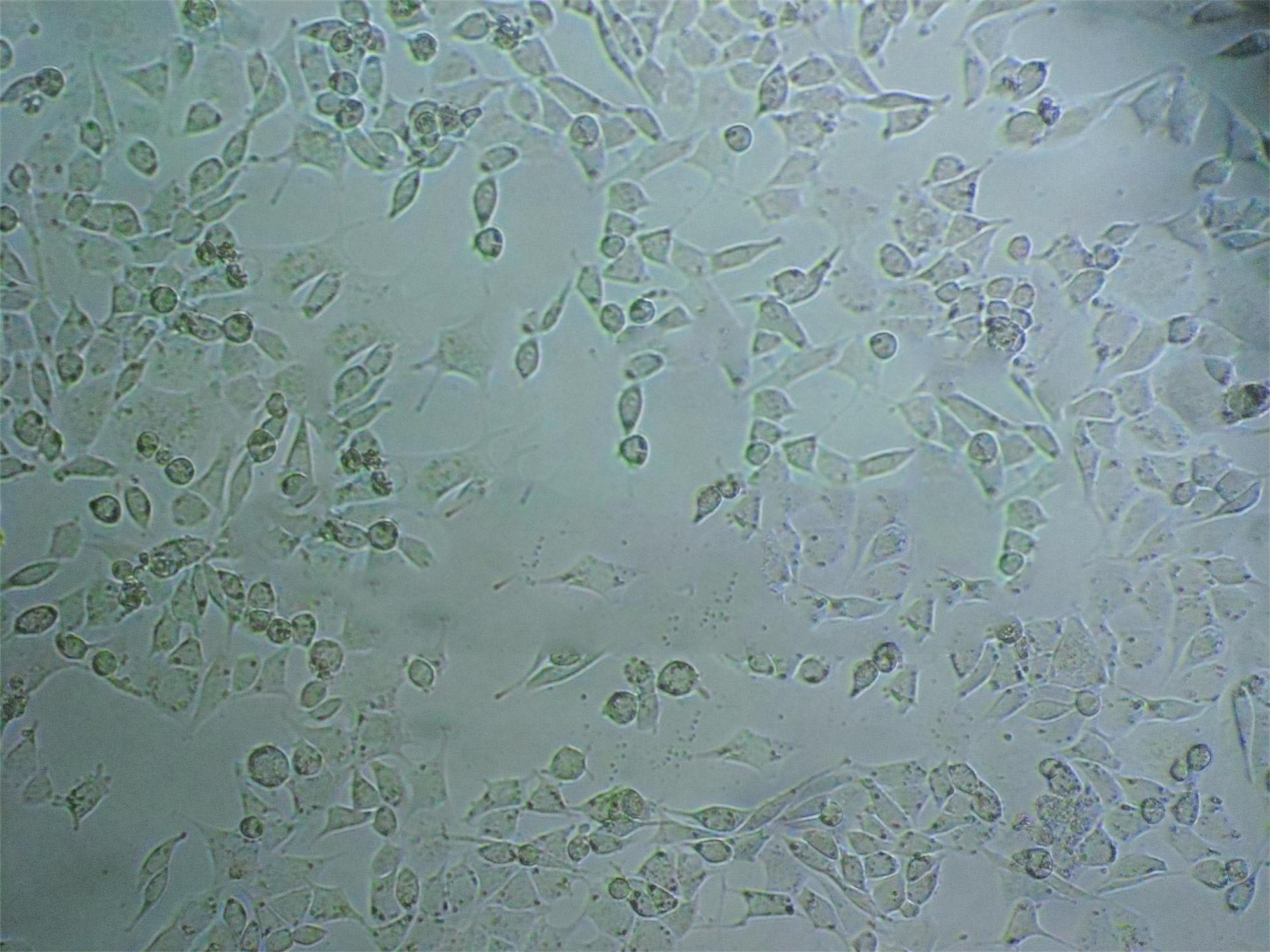 BEL-7404 Cells(赠送Str鉴定报告)|人肝癌细胞