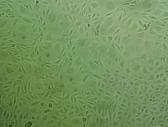 NCI-H520 Cells(赠送Str鉴定报告)|人肺腺鳞癌细胞