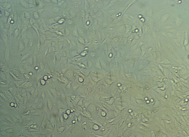 hMSC-BM Cells(赠送Str鉴定报告)|人间充质干细胞