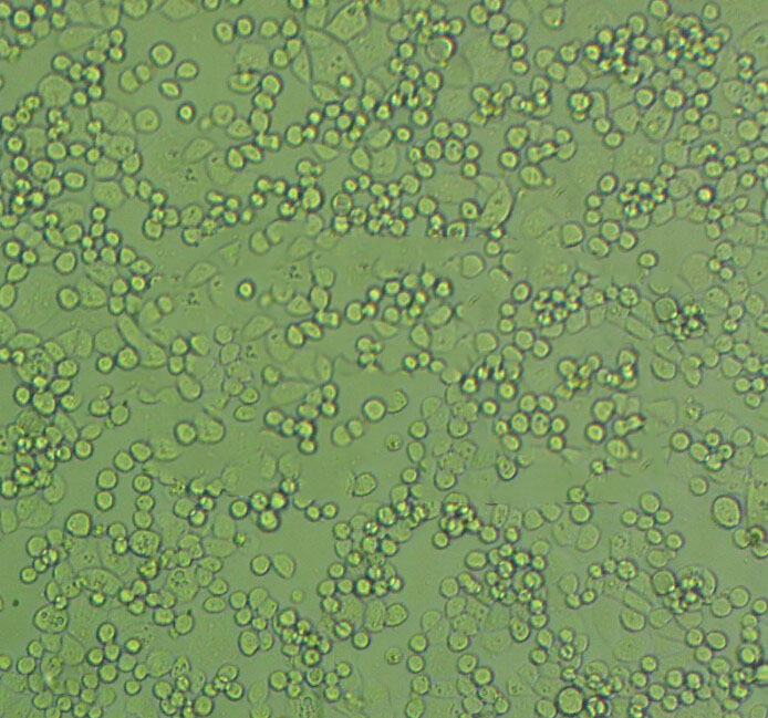 A2780 Cells(赠送Str鉴定报告)|人卵巢癌细胞