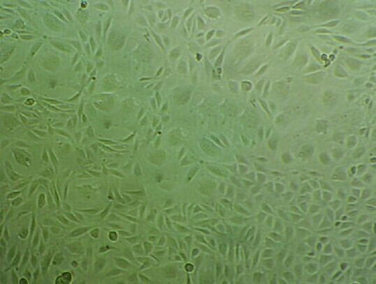 J82 Cells(赠送Str鉴定报告)|人膀胱移行癌细胞