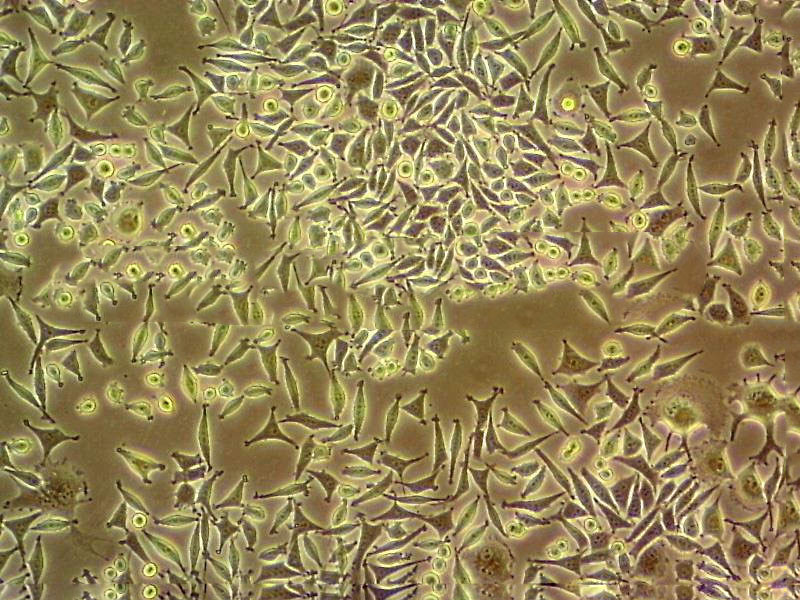 HaCaT Cells(赠送Str鉴定报告)|人永生化表皮细胞