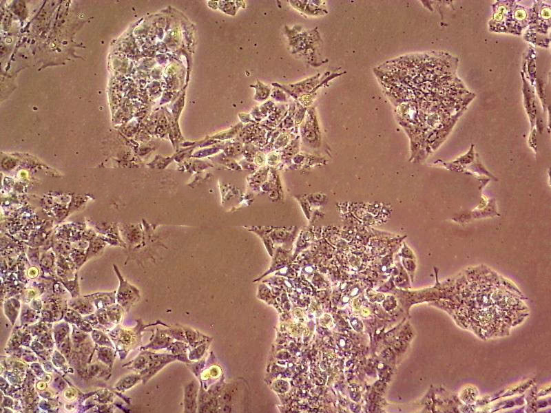 22Rv1 Cells(赠送Str鉴定报告)|人前列腺癌细胞