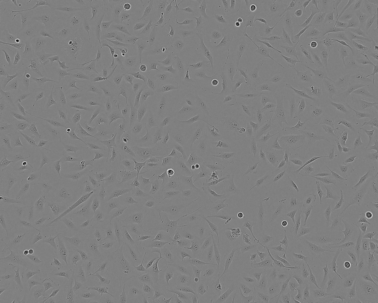 MDA-MB-468 Cells(赠送Str鉴定报告)|人乳腺癌细胞