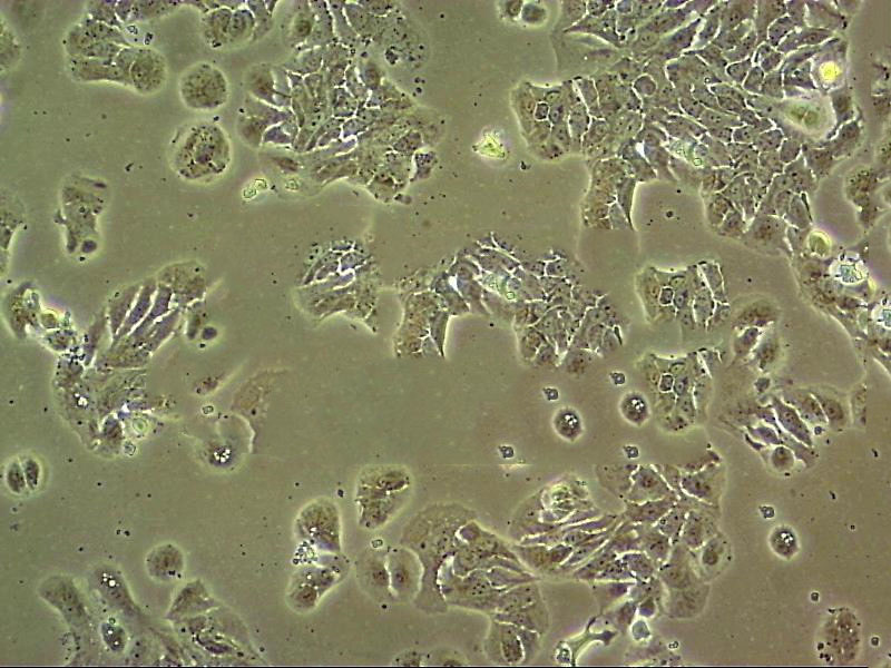 Caki-1 Cells(赠送Str鉴定报告)|人肾透明细胞癌细胞