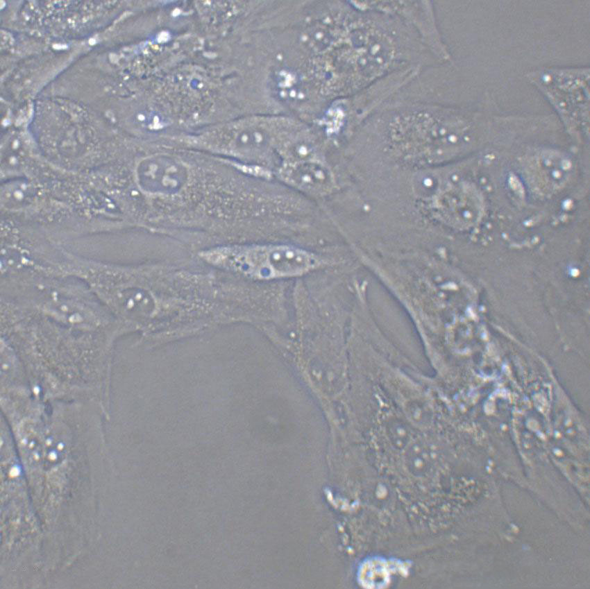 SCC-9 Cells(赠送Str鉴定报告)|人类鳞状上皮舌癌细胞