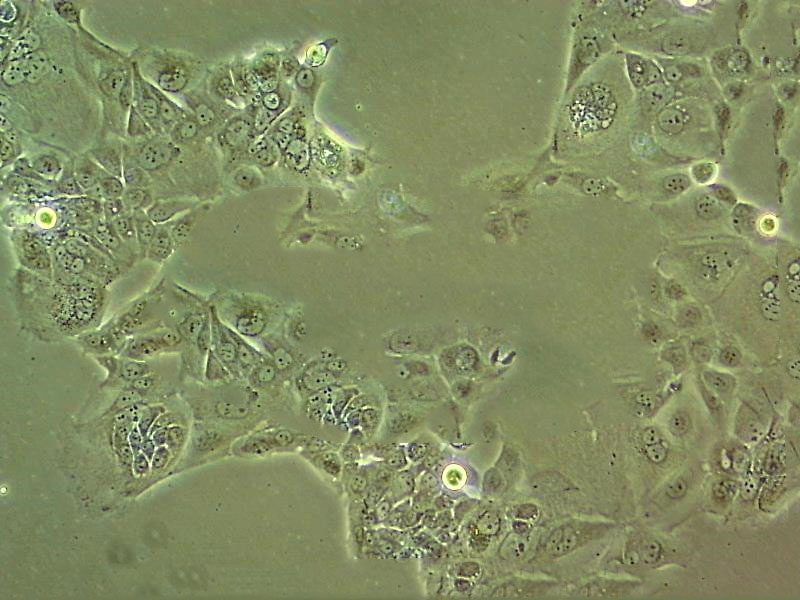 SCC-4 Cells(赠送Str鉴定报告)|人类鳞状上皮舌癌细胞