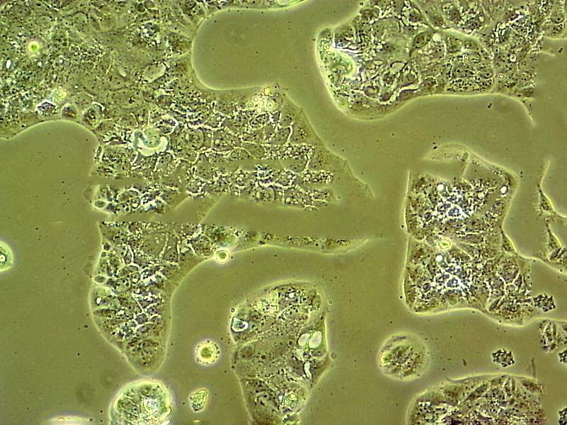 JEG-3 Cells(赠送Str鉴定报告)|人绒毛膜癌细胞