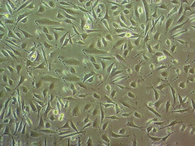 PANC-1 Cells(赠送Str鉴定报告)|人胰腺癌细胞