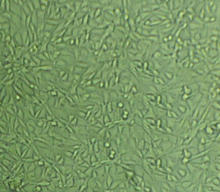 AN3-CA Cells(赠送Str鉴定报告)|人子宫内膜腺癌细胞
