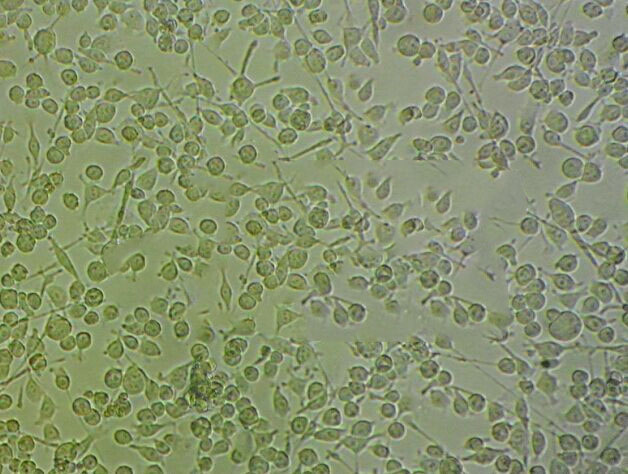 RL95-2 Cells(赠送Str鉴定报告)|人子宫内膜癌细胞