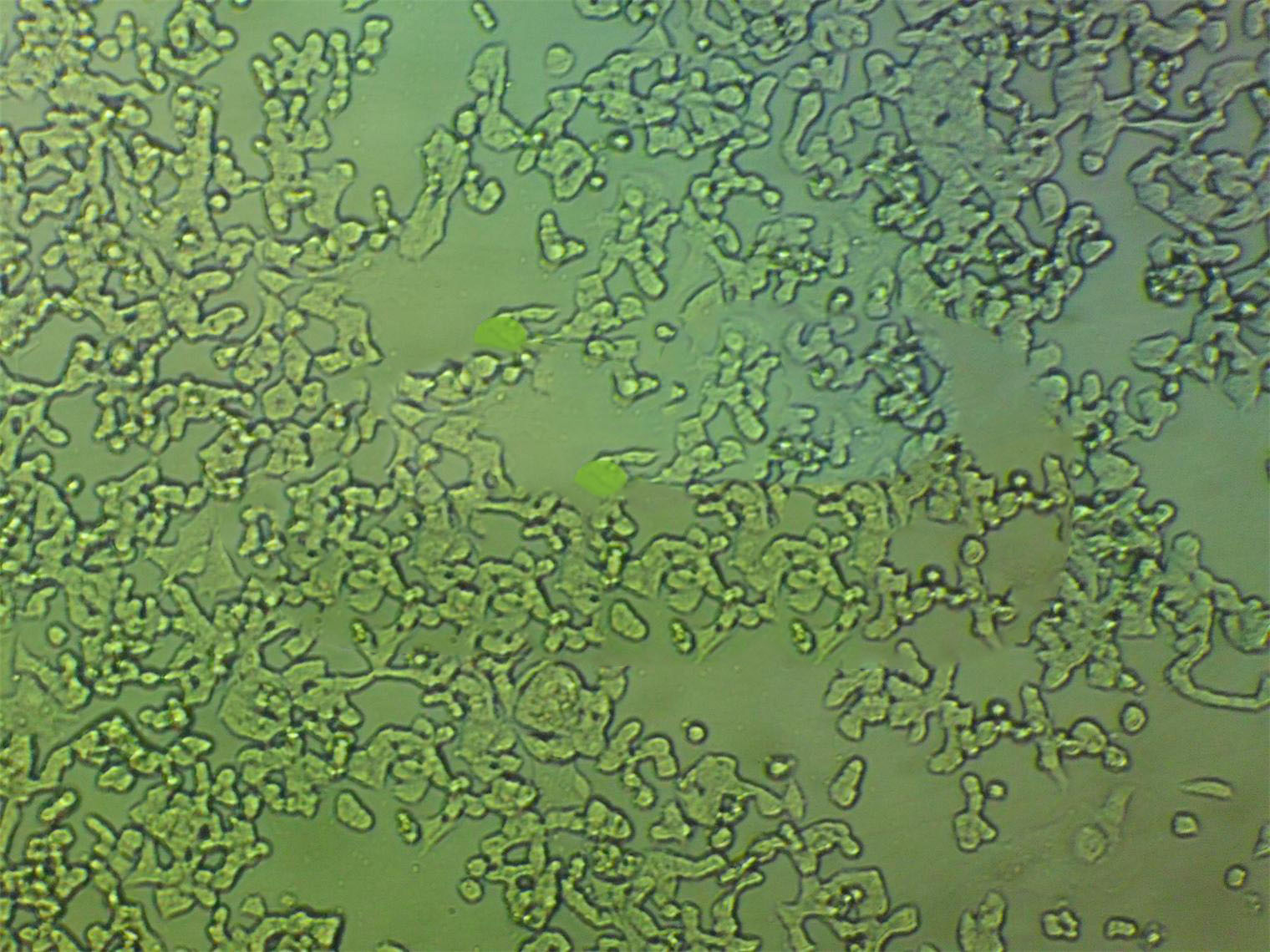 HEC-1-B Cells(赠送Str鉴定报告)|人子宫内膜癌细胞