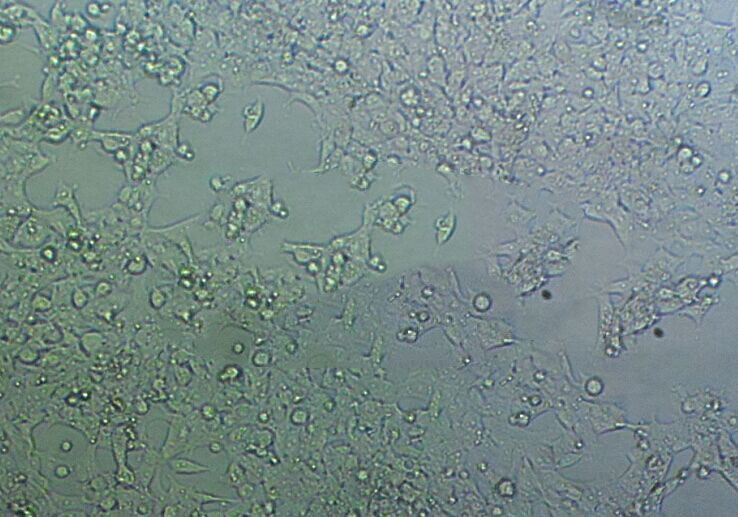 HEC-1-A Cells(赠送Str鉴定报告)|人子宫内膜癌细胞