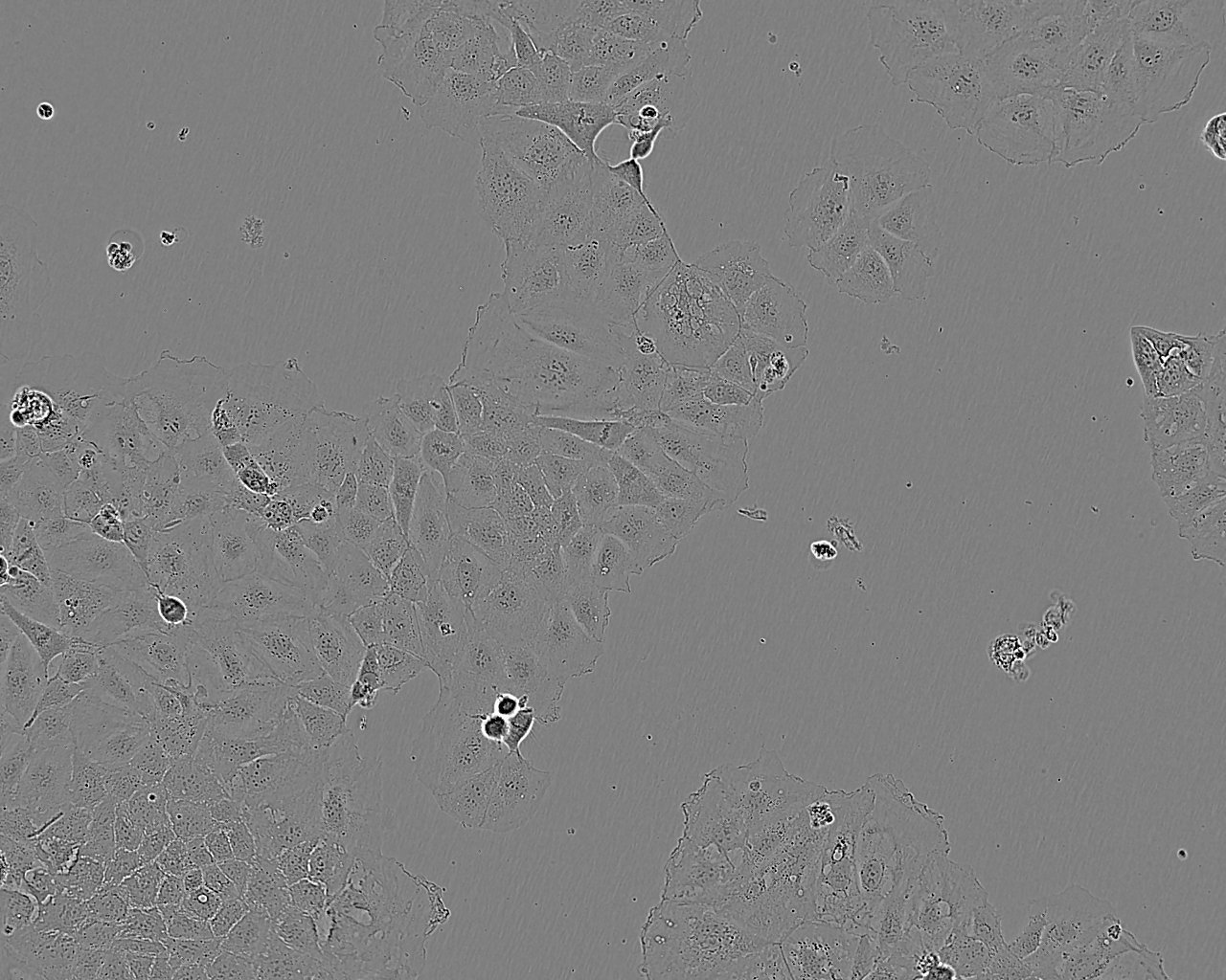 KB Cell|口腔表皮样癌细胞