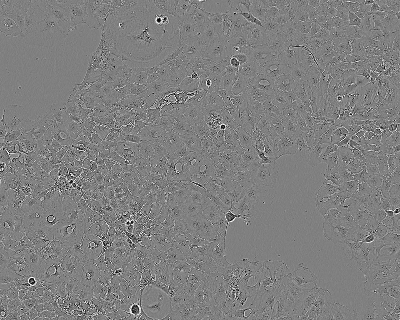 ES-2 Cell|人卵巢癌细胞