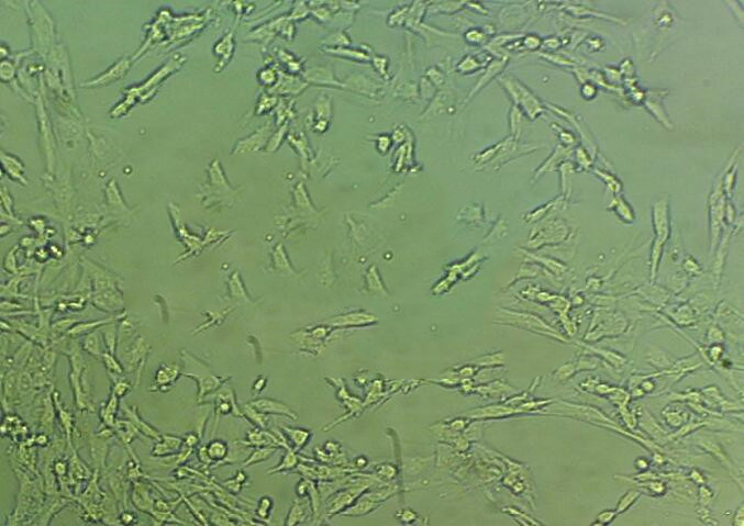 FaDu Cell|人咽鳞癌细胞