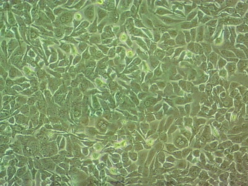 AN3-CA Cell|人子宫内膜腺癌细胞