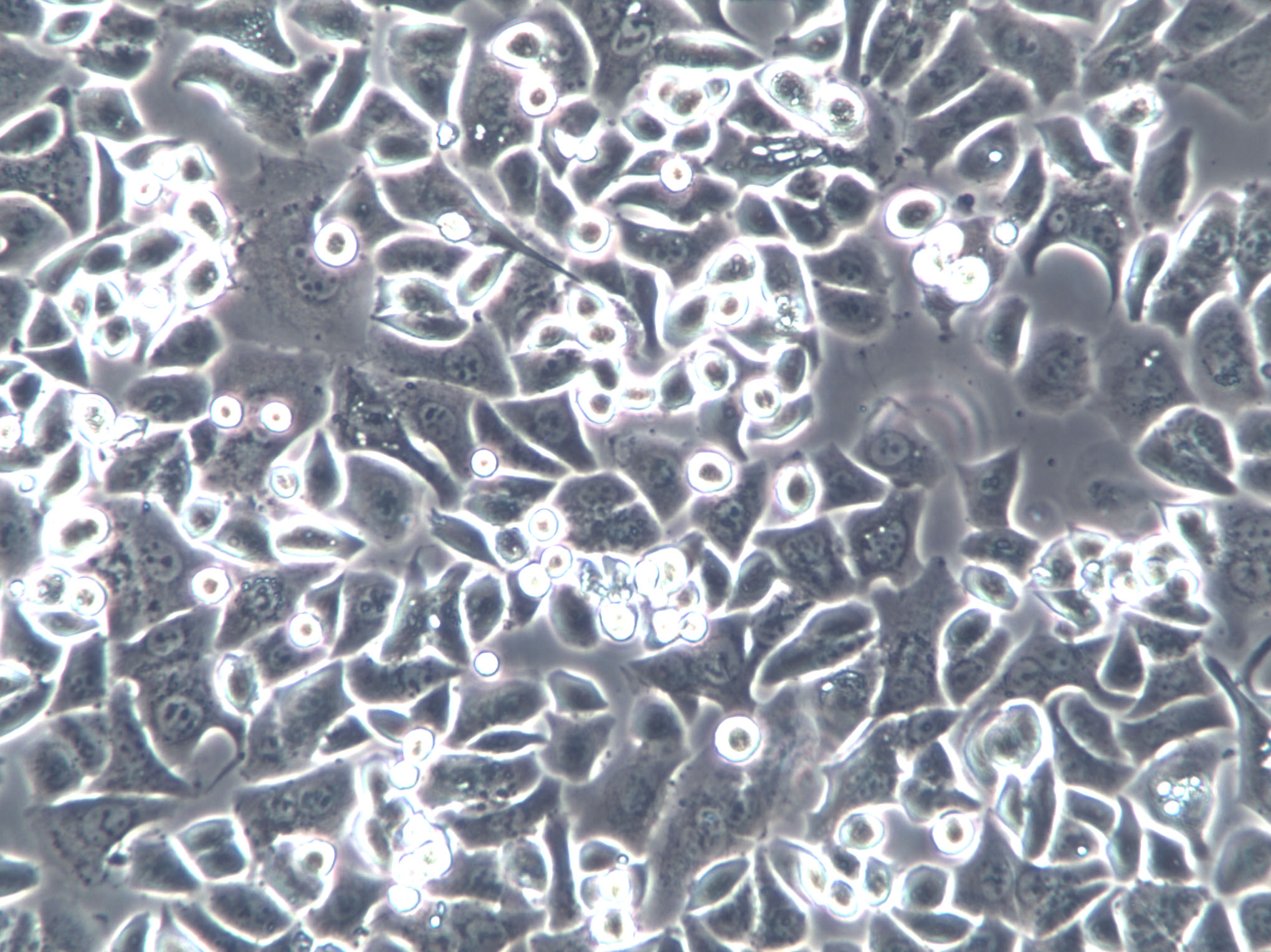 NCI-H2172 Cell|人非小细胞肺癌细胞