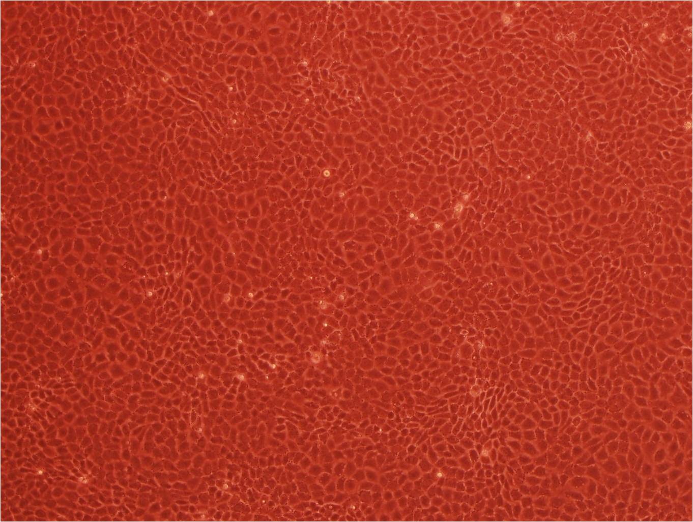 NCI-H1048 Cell|人小细胞肺癌细胞