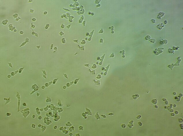 OE21 Cell|人食道鳞状癌细胞