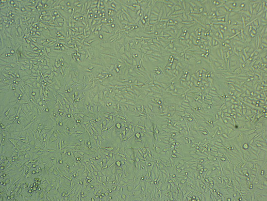 COV362 Cell|人卵巢癌细胞